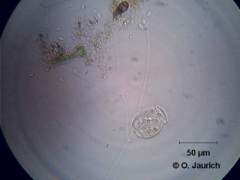 Glockentier (Vorticella microstoma), gestreckt 600x HF