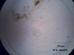 Glockentier (Vorticella microstoma), zusammengezogen 600x HF