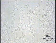 Bakterien in Kahmhaut auf Blumenwasser 1100x HF SB