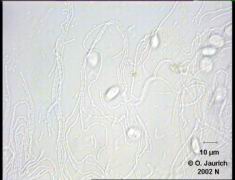 Bakterien in Kahmhaut auf Blumenwasser 1100x HF SB