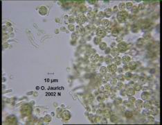 Grünalge Chlorococcum und Bakterien 680x HF