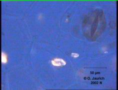 Dieffenbachia Spaltöffnung, Epidermis- Zellen, eingelagerte Kristalle 680x HF pol