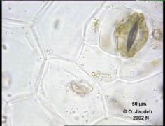 Dieffenbachia Spaltöffnung, Epidermis-Zellen, eingelagerte Kristalle 680x HF