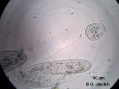 TN_Ohren-Pantoffeltier (Paramecium aurelia), Glockentier (Vorticella microstoma) 600x HF