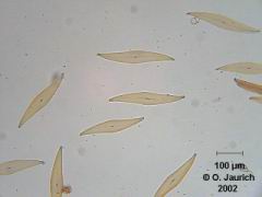 Kieselalge Pleurasigma angulatum 150x HF