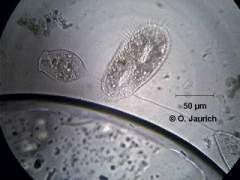 Birneninfusor (Tetrahymena pyriformis) ?, Glockentier (Vorticella microstoma) 600x HF